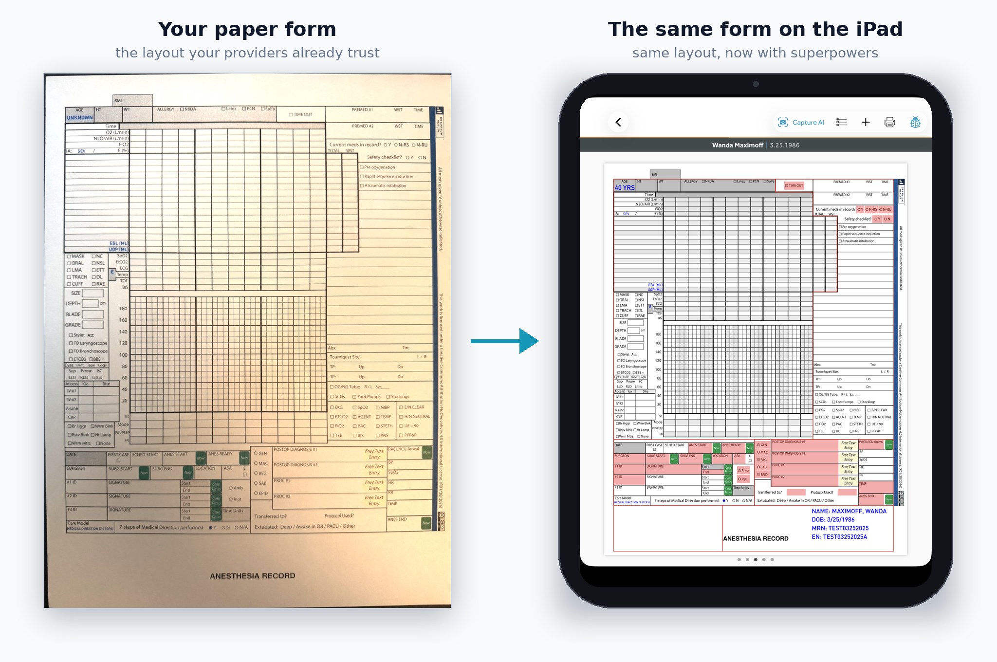 Side by side: the printed Graphium anesthesia record on paper, and the same record rendered on an iPad with required fields highlighted in red