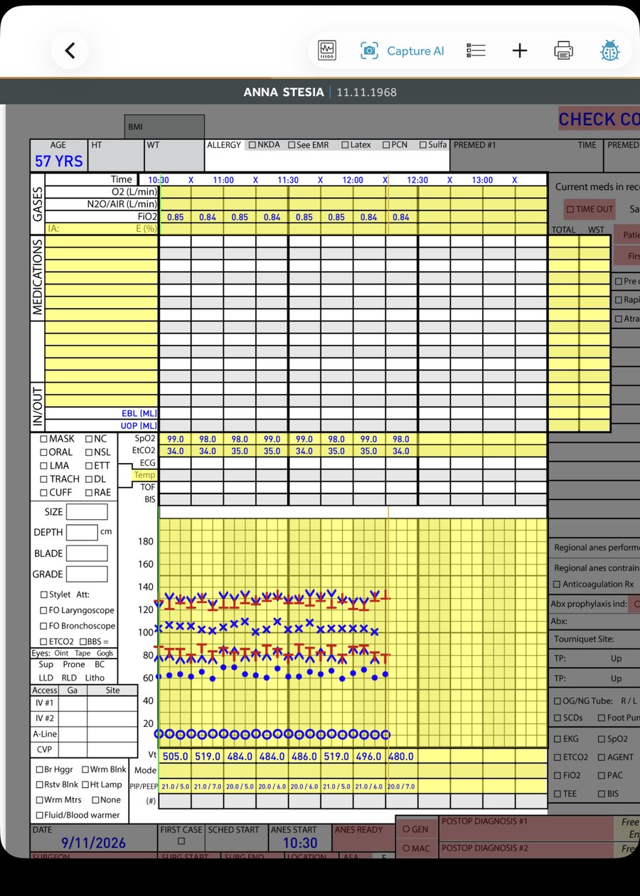 AnesthesiaEMR on iPad: vitals streaming from the monitor onto the chart grid, with SpO2, EtCO2, FiO2, blood pressure, and heart rate charted automatically every five minutes